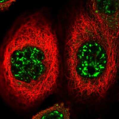 Immunocytochemistry/ Immunofluorescence: FOXO4 Antibody [NBP2-58083]