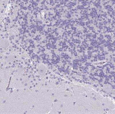 Immunohistochemistry-Paraffin: FOXO4 Antibody [NBP2-32614]