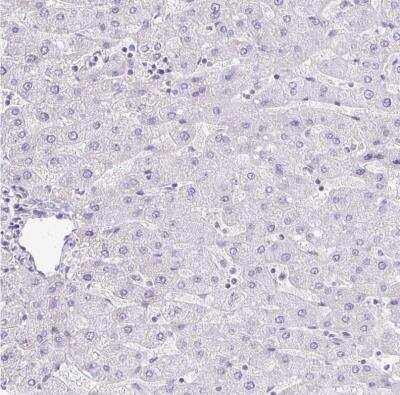 Immunohistochemistry-Paraffin: FOXO4 Antibody [NBP2-32614]