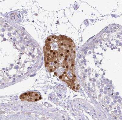 Immunohistochemistry-Paraffin: FOXO4 Antibody [NBP2-32614]