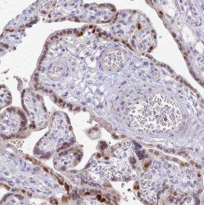 Immunohistochemistry-Paraffin: FOXO4 Antibody [NBP2-32614]