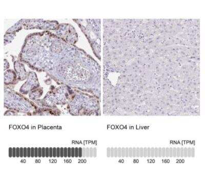 Immunohistochemistry-Paraffin: FOXO4 Antibody [NBP2-32614]