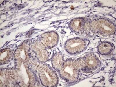 Immunohistochemistry: FOXO4 Antibody (OTI1A4) - Azide and BSA Free [NBP2-71198]