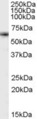 Western Blot: FOXO4 Antibody [NB100-59745]