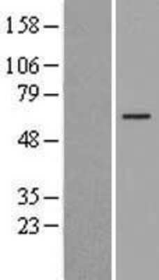 Western Blot: FOXO4 Overexpression Lysate [NBL1-10815]