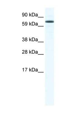 Western Blot: FOXO6 Antibody [NBP1-91611]