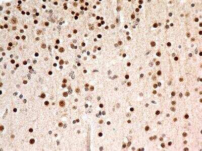 Immunohistochemistry-Paraffin: FoxP1 Antibody (JC12) - BSA Free [NB100-65125]