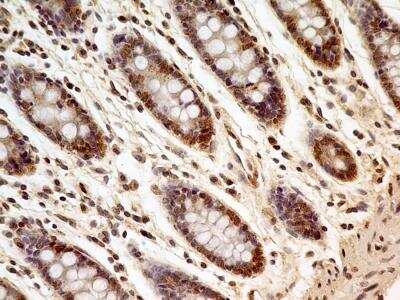 Immunohistochemistry-Paraffin: FoxP1 Antibody (JC12) - BSA Free [NB100-65125]