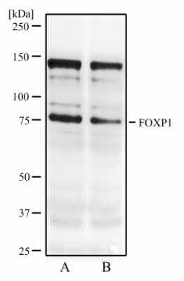 Western Blot: FoxP1 Antibody (JC12)BSA Free [NB100-65125]