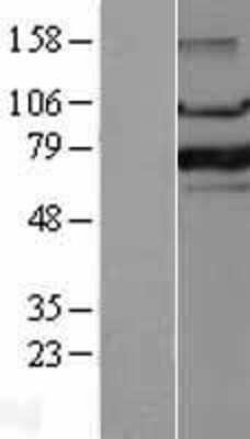 Western Blot: FoxP1 Overexpression Lysate [NBL1-10816]