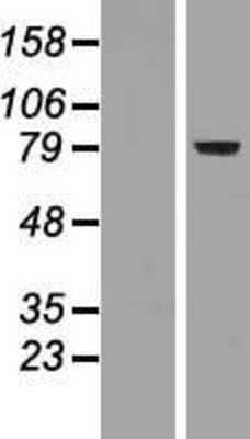 Western Blot: FoxP2 Overexpression Lysate [NBP2-05428]