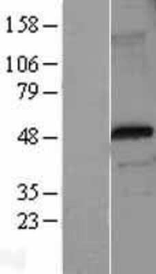 Western Blot: FoxP3 Overexpression Lysate [NBL1-10817]