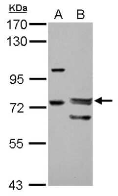 Western Blot: FoxP4 Antibody [NBP2-16524]