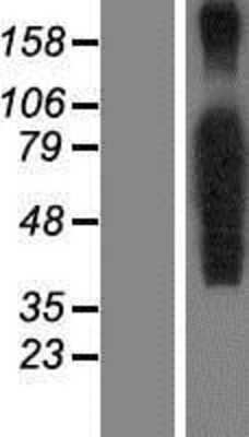 Western Blot: FoxP4 Overexpression Lysate [NBP2-05654]