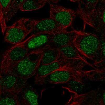 Immunocytochemistry/ Immunofluorescence: FOXQ1 Antibody [NBP2-56026]