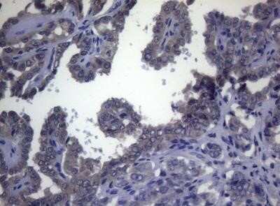 Immunohistochemistry: FOXQ1 Antibody (OTI4D9) - Azide and BSA Free [NBP2-72338]