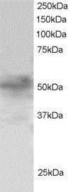 Western Blot: FOXQ1 Antibody [NB100-1283]