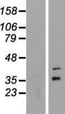 Western Blot: FOXR1 Overexpression Lysate [NBL1-10820]