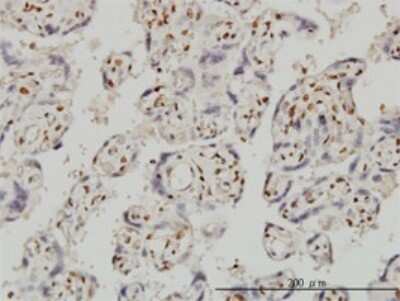 Immunohistochemistry-Paraffin: FOXR2 Antibody (2C1) [H00139628-M01]