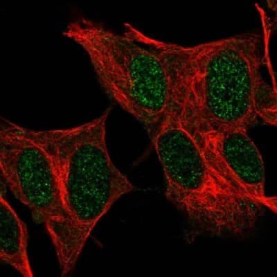 Immunocytochemistry/ Immunofluorescence: FOXR2 Antibody [NBP1-81870]