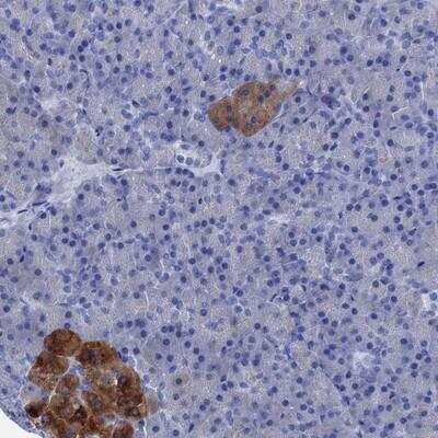 Immunohistochemistry-Paraffin: FOXR2 Antibody [NBP1-81870]