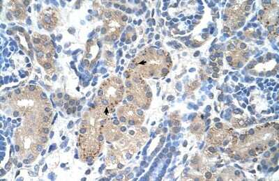 Immunohistochemistry-Paraffin: FOXR2 Antibody [NBP1-80511]