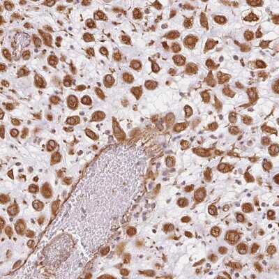Immunohistochemistry-Paraffin: FOXR2 Antibody [NBP2-56756]