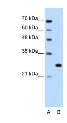 Western Blot: FOXR2 Antibody [NBP1-80511]