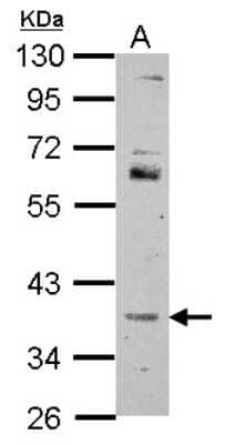 Western Blot: FOXR2 Antibody [NBP2-16525]