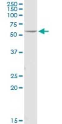 Western Blot: FOXRED1 Antibody [H00055572-B01P]