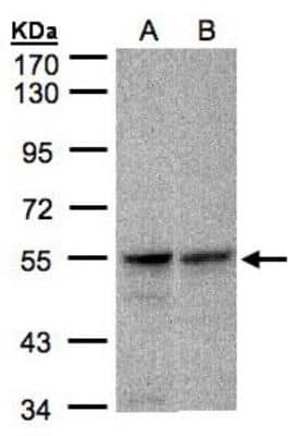 Western Blot: FOXRED1 Antibody [NBP1-31570]