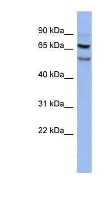 Western Blot: FOXRED1 Antibody [NBP1-57478]