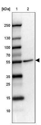 Western Blot: FOXRED1 Antibody [NBP2-14025]