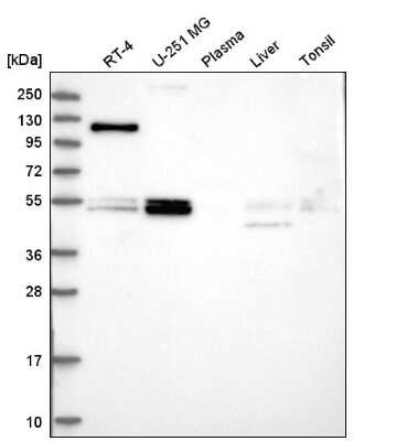 Western Blot: FOXRED1 Antibody [NBP2-58140]