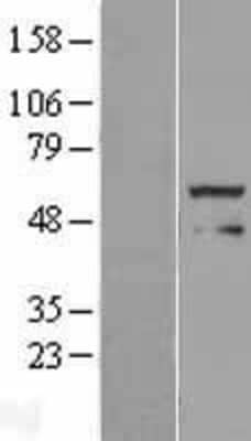 Western Blot: FOXRED1 Overexpression Lysate [NBL1-10822]