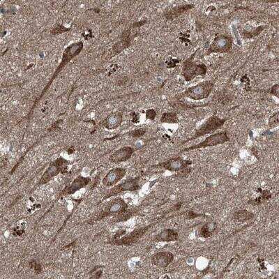 Immunohistochemistry: FOXRED2 Antibody [NBP1-82084]