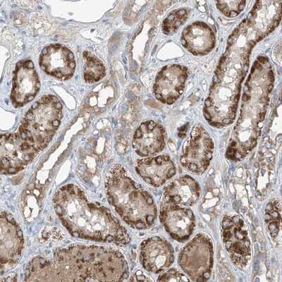 Immunohistochemistry-Paraffin: FOXRED2 Antibody [NBP1-82083]