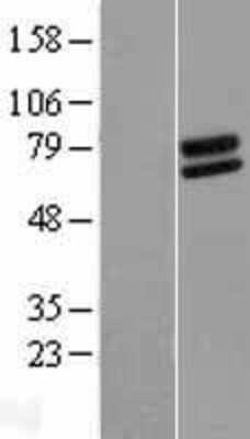 Western Blot: FOXRED2 Overexpression Lysate [NBL1-10823]