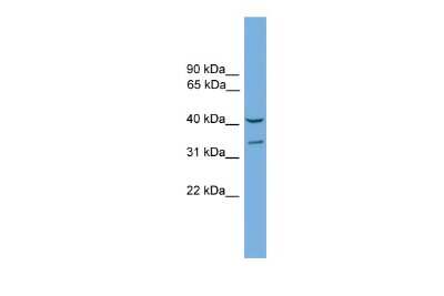 Western Blot: FOXS1 Antibody [NBP2-84032]