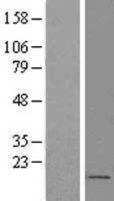 Western Blot: FOXS1 Overexpression Lysate [NBP2-07907]