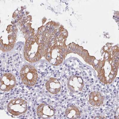 Immunohistochemistry: FPGS Antibody [NBP2-48965]