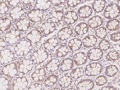 Immunohistochemistry: FPGS Antibody [NBP3-06209]