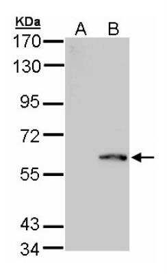 Western Blot: FPGS Antibody [NBP2-16526]