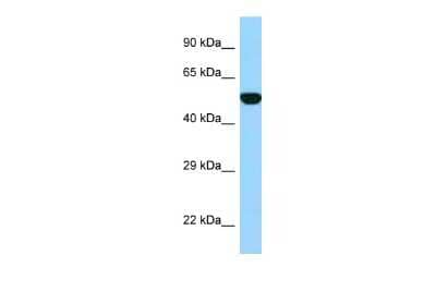 Western Blot: FPGS Antibody [NBP2-84941]