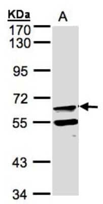 Western Blot: FPGT Antibody [NBP1-31436]