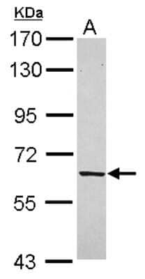 Western Blot: FPGT Antibody [NBP2-16527]