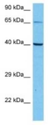 Western Blot: FPR-RS6 Antibody [NBP3-10211]