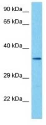 Western Blot: FPR-RS7 Antibody [NBP3-10207]