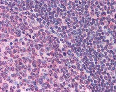 Immunohistochemistry-Paraffin: FPR1 Antibody - BSA Free [NLS2086]