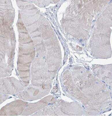 Immunohistochemistry-Paraffin: FPRL1/FPR2 Antibody [NBP1-90180]